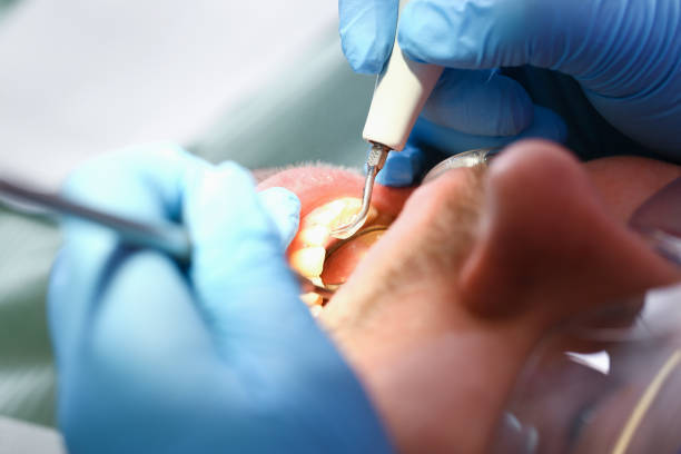 Best Emergency Wisdom Teeth Removal in Caway, AR