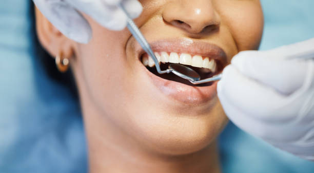 Best Emergency Dental Care for Broken or Chipped Teeth in Caway, AR